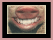 winning web grin